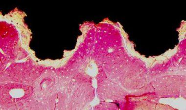 osseo integration histology